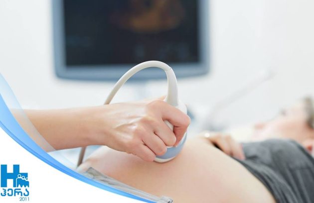 ულტრათანამედროვე, მაღალტექნოლოგიური აპარატი GE Voluson E8 კლინიკა #HERA2011 -ში!